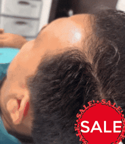 ! NUEVO SERUM ANTI-CAIDA; RECUPERA TU CABELLO EN 3 SEMANAS !